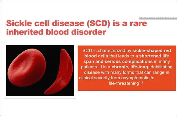 NOVARTIS Sheds Light and Pioneers in Research and Activities to Raise Awareness on Sickle Cell Disease