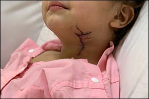 Tabuk Surgeons Save 2-year-old from Fatal Glass Table Wound