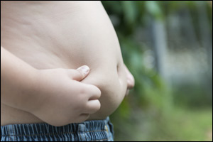 Obese children at risk of developing three or more adult health problems, more likely to become overweight or obese adults
