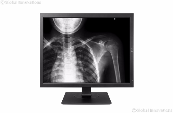 LG Unveils Expanded Medical Imaging Product Lineup at Medica 2017