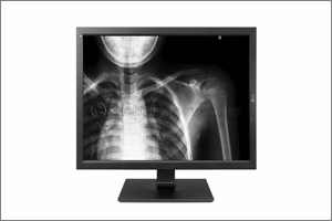 LG Unveils Expanded Medical Imaging Product Lineup at Medica 2017