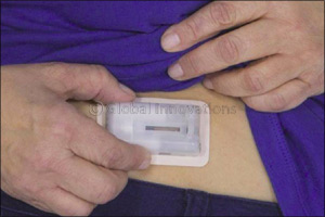 Julphar to Launch Wearable Insulin Delivery Device in GCC