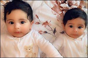 SEHA's Advanced in-Womb Laser Procedure Greatly Improves Chances of Survival for Unborn Identical Twins Suffering from Rare Condition